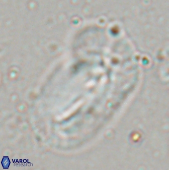 Helicosphaera distincta 29853