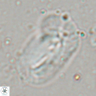 Helicosphaera distincta 29853