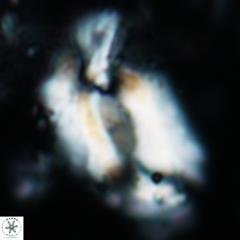 Helicosphaera euphratis 367