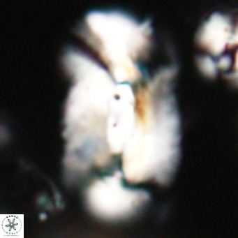Helicosphaera euphratis VR 028446
