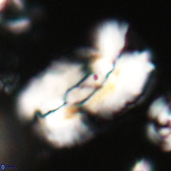 Helicosphaera euphratis VR 028449