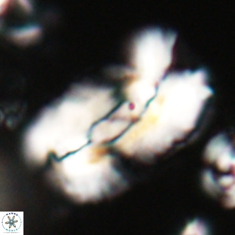 Helicosphaera euphratis VR 028449