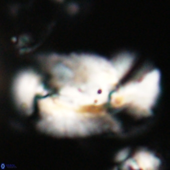 Helicosphaera euphratis VR 028450