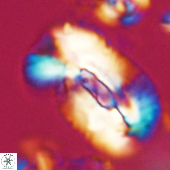 Helicosphaera euphratis VR 028452