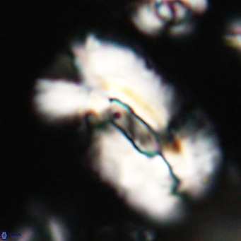 Helicosphaera euphratis VR 028453