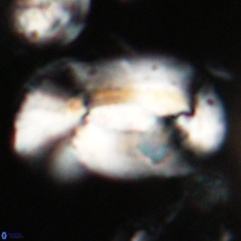 Helicosphaera euphratis VR 028454
