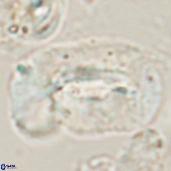 Helicosphaera euphratis VR 028456