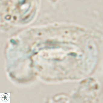Helicosphaera euphratis VR 028456
