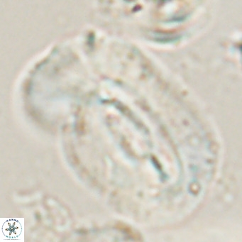 Helicosphaera euphratis VR 028457