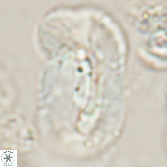 Helicosphaera euphratis VR 028458