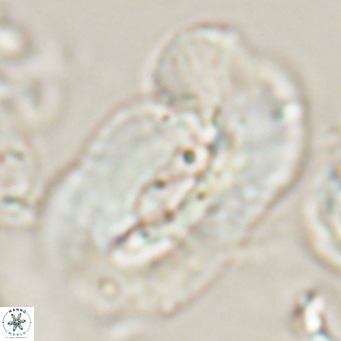 Helicosphaera euphratis VR 028459
