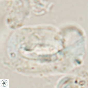 Helicosphaera euphratis VR 028461