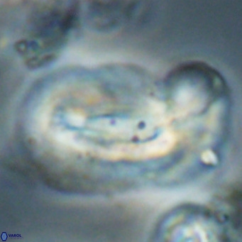 Helicosphaera euphratis VR 028462