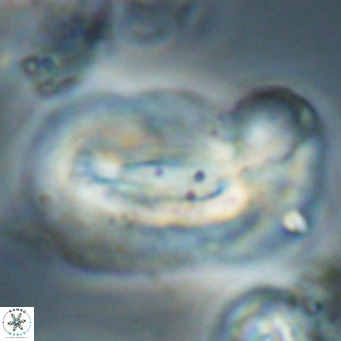 Helicosphaera euphratis VR 028462