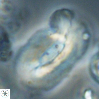 Helicosphaera euphratis VR 028463