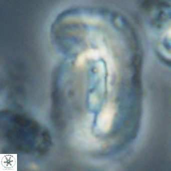 Helicosphaera euphratis VR 028464