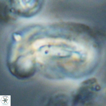 Helicosphaera euphratis VR 028466