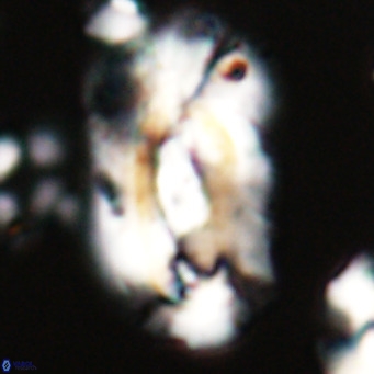 Helicosphaera euphratis VR 24255