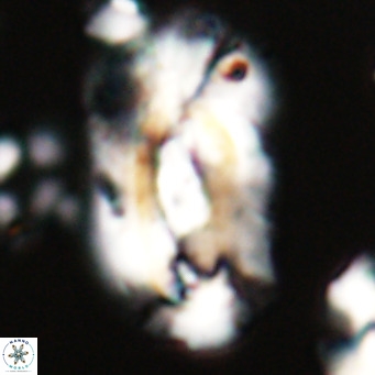 Helicosphaera euphratis VR 24255