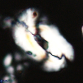 Helicosphaera euphratis VR 24256