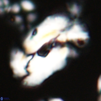 Helicosphaera euphratis VR 24258