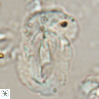 Helicosphaera euphratis VR 24264