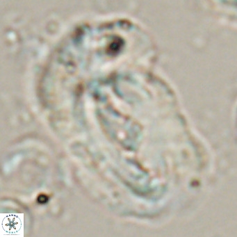Helicosphaera euphratis VR 24265