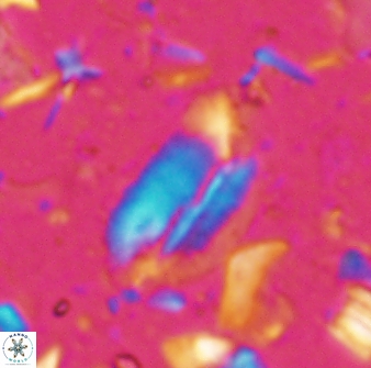 Helicosphaera elongata 28124