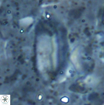 Helicosphaera elongata 28127