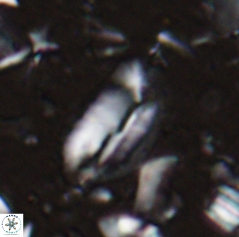 Helicosphaera elongata 28123