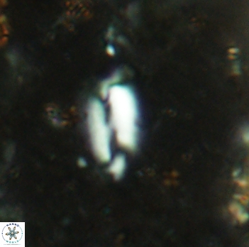 Helicosphaera elongata 2340