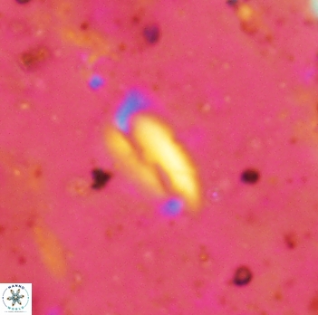 Helicosphaera elongata 2342