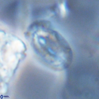 Helicosphaera epimikeisporous VR 04140