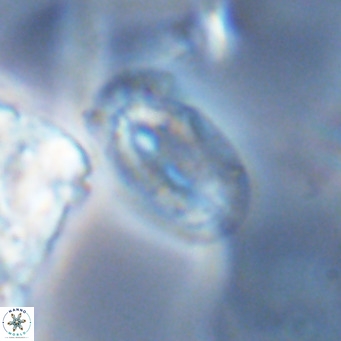 Helicosphaera epimikeisporous VR 04140