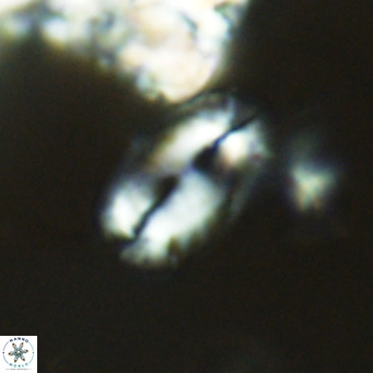 Helicosphaera epimikeisporous VR 04129