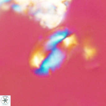 Helicosphaera epimikeisporous VR 04130