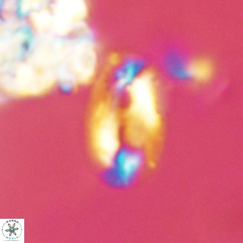 Helicosphaera epimikeisporous VR 04131