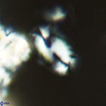 Helicosphaera epimikeisporous VR 04133