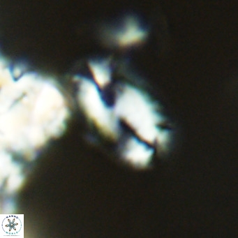 Helicosphaera epimikeisporous VR 04133