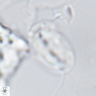 Helicosphaera epimikeisporous VR 04135