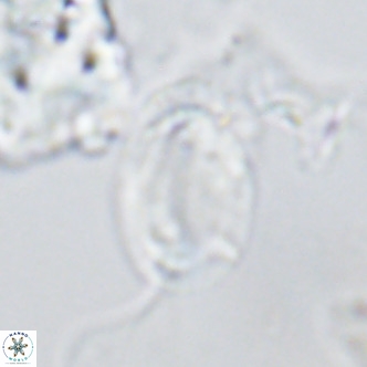 Helicosphaera epimikeisporous VR 04136