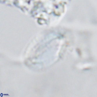 Helicosphaera epimikeisporous VR 04137