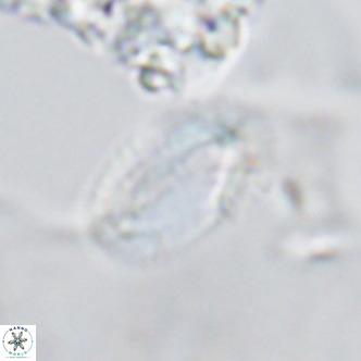 Helicosphaera epimikeisporous VR 04137