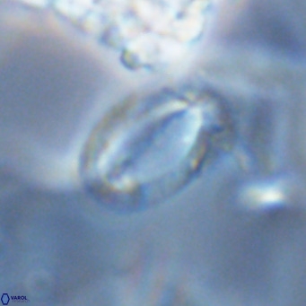 Helicosphaera epimikeisporous VR 04138