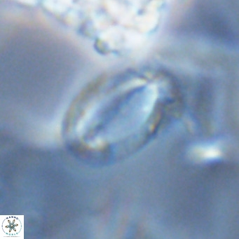 Helicosphaera epimikeisporous VR 04138