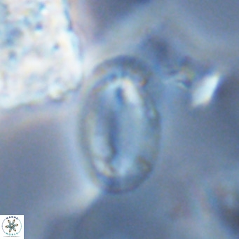 Helicosphaera epimikeisporous VR 04139