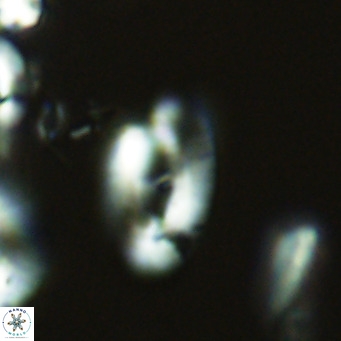 Helicosphaera epimikeisporous VR 04608