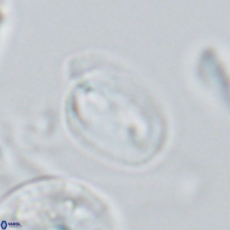 Helicosphaera epimikeisporous VR 04614