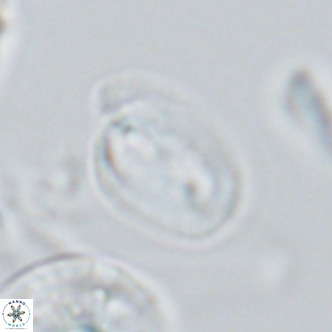 Helicosphaera epimikeisporous VR 04614