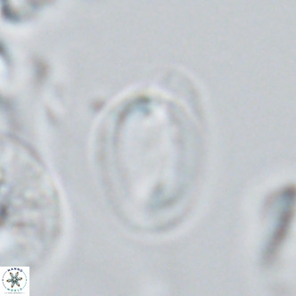 Helicosphaera epimikeisporous VR 04615